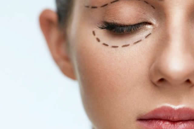 RESULTADOS LIPOVASER EN QUITO