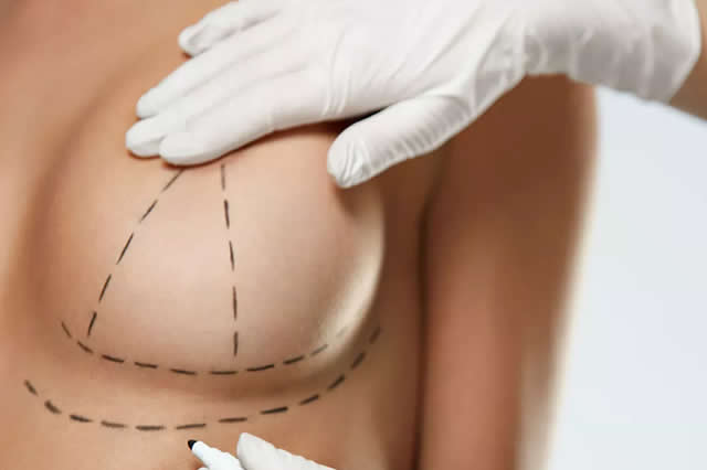 RESULTADOS LIPOVASER EN QUITO