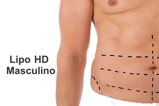 LIPO  HD MASCULINO