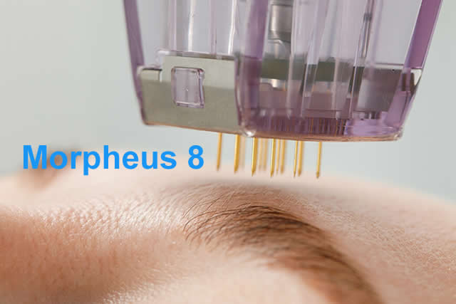 MORPHEUS8